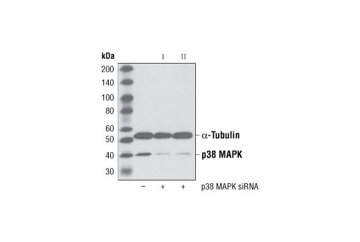 SignalSilence® p38 MAPK siRNA II - 300 ul