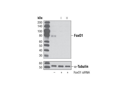 SignalSilence® FoxO1 siRNA II - 300 ul