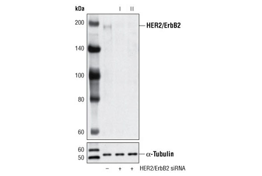 SignalSilence® HER2/ErbB2 siRNA I - 300 ul