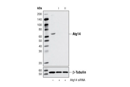 SignalSilence® Atg14 siRNA I - 300 ul