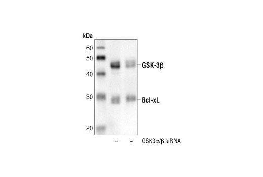 SignalSilence® GSK-3α/β siRNA - 300 ul