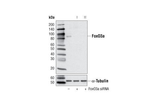 SignalSilence® FoxO3a siRNA I - 300 ul