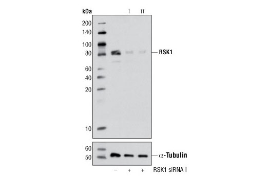 SignalSilence® RSK1 siRNA I - 300 ul