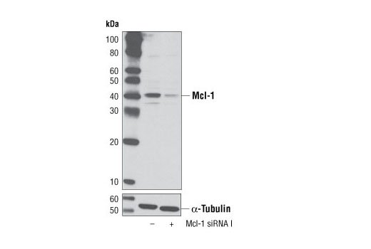 SignalSilence® Mcl-1 siRNA I - 300 ul