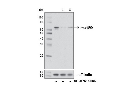 SignalSilence® NF-κB p65 siRNA I (Mouse Specific) - 300 ul