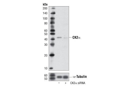 SignalSilence® CK2α siRNA I - 300 ul