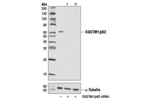 SignalSilence® SQSTM1/p62 siRNA II - 300 ul