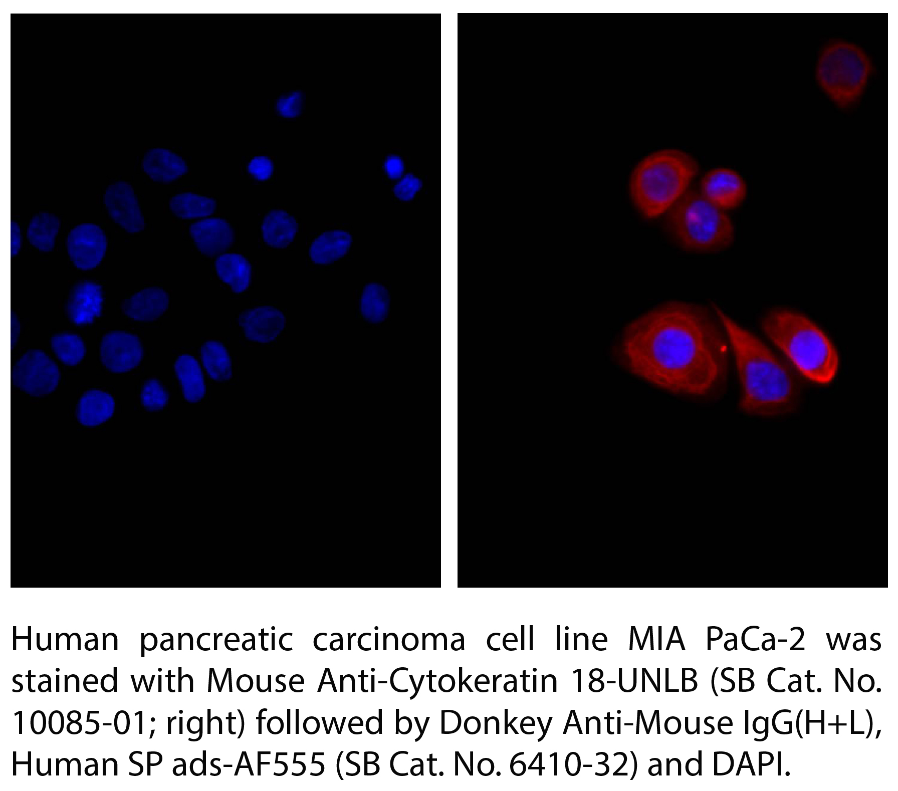 Donkey Anti-Mouse IgG(H+L), Human SP ads-AF555 - 1.0 mg