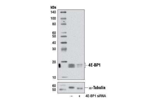 SignalSilence® 4E-BP1 siRNA I - 300 ul