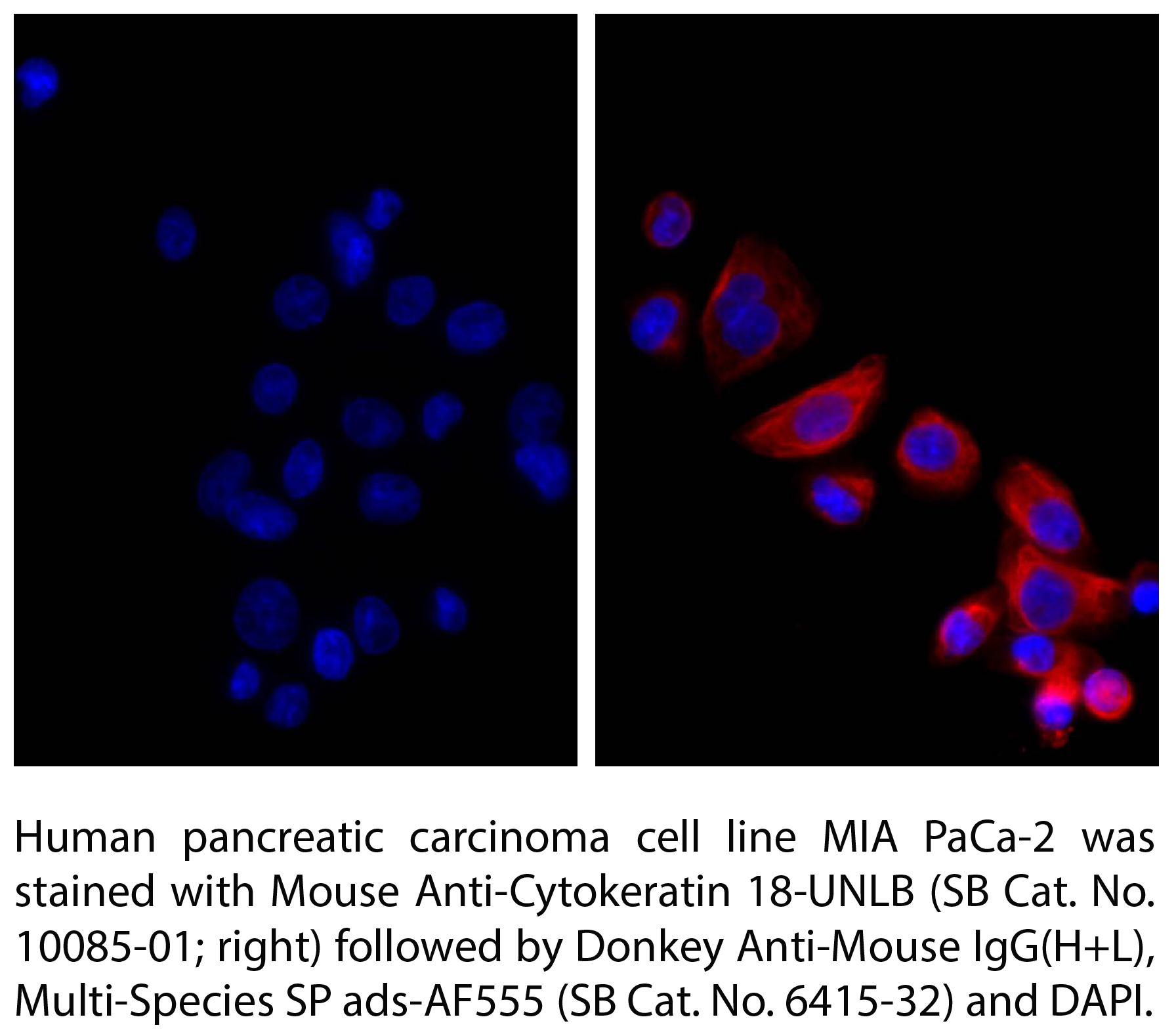 Donkey Anti-Mouse IgG(H+L), Multi-Species SP ads-AF555 - 1.0 mg