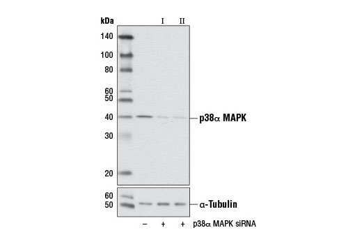 SignalSilence® p38α MAPK siRNA I (Mouse Specific) - 300 ul