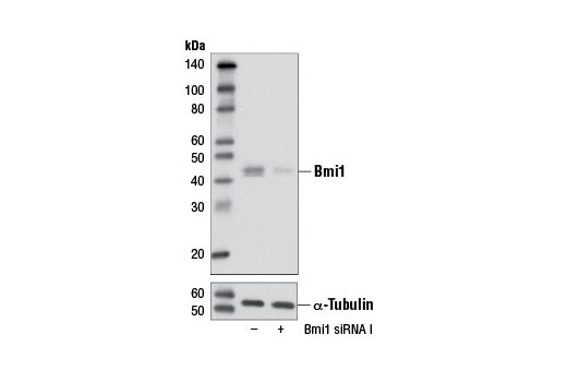 SignalSilence® Bmi1 siRNA I - 300 ul