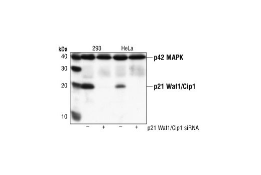 SignalSilence® p21 Waf1/Cip1 siRNA I - 300 ul