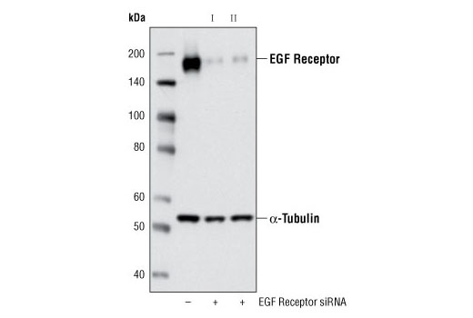 SignalSilence® EGF Receptor siRNA II - 300 ul