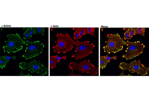 Focal Adhesion Protein Antibody Sampler Kit - 1 Kit