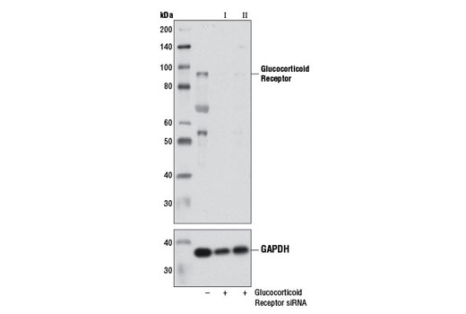 SignalSilence® Glucocorticoid Receptor siRNA I - 300 ul