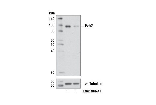 SignalSilence® Ezh2 siRNA I - 300 ul