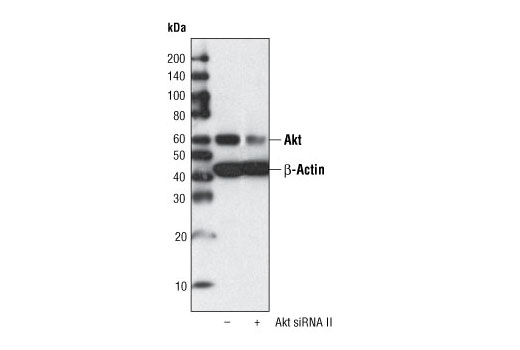 SignalSilence® Akt siRNA II - 300 ul