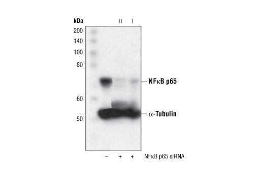 SignalSilence® NF-κB p65 siRNA II - 300 ul