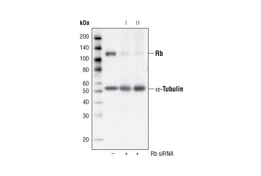 SignalSilence® Rb siRNA II - 300 ul