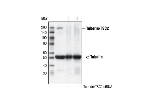 SignalSilence® Tuberin/TSC2 siRNA I - 300 ul