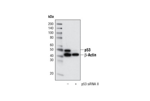 SignalSilence® p53 siRNA II - 300 ul