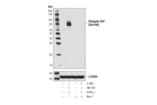 Apoptosis/Necroptosis Antibody Sampler Kit - 1 Kit