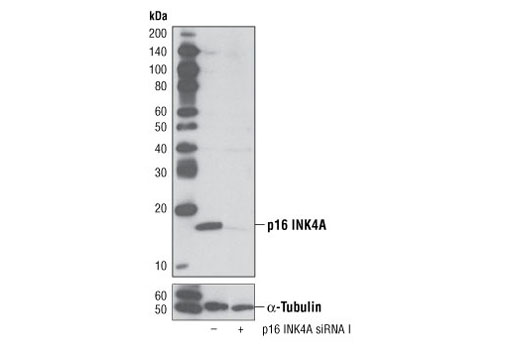 SignalSilence® p16 INK4A siRNA I - 300 ul