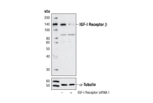 SignalSilence® IGF-I Receptor siRNA I - 300 ul