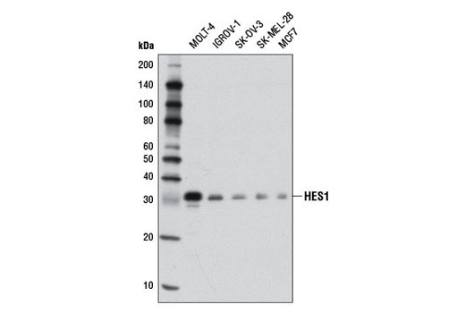 Notch Activated Targets Antibody Sampler Kit - 1 Kit