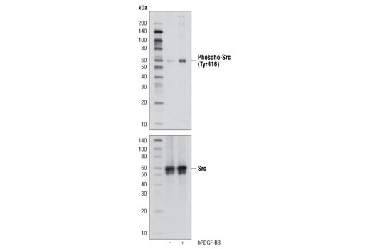 Src Antibody Sampler Kit - 1 Kit