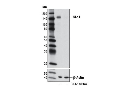 SignalSilence® ULK1 siRNA I - 300 ul