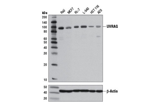 Autophagy Vesicle Nucleation Antibody Sampler Kit - 1 Kit