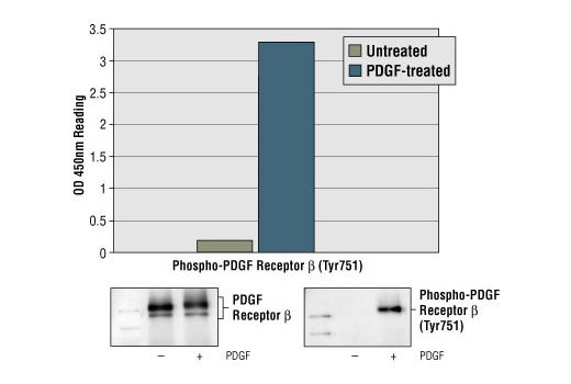 PathScan® Phospho-PDGF Receptor β (Tyr751) Sandwich ELISA Kit - 1 Kit