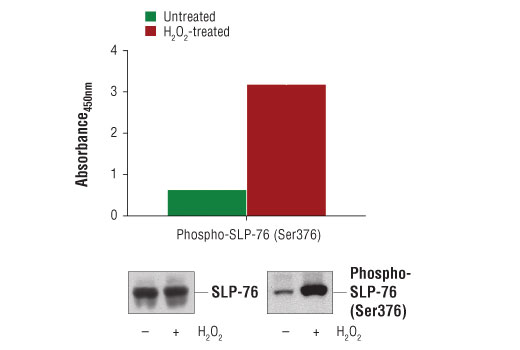 PathScan® Phospho-SLP-76 (Ser376) Sandwich ELISA Kit - 1 Kit