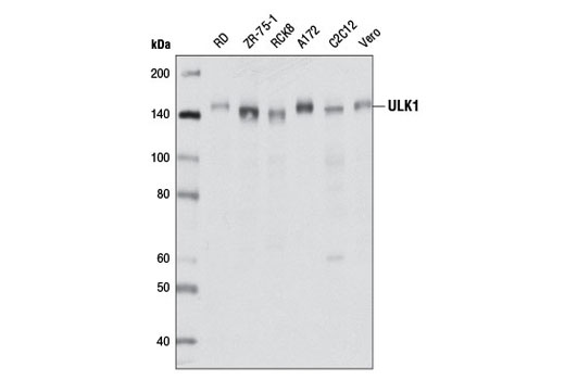 PhosphoPlus® ULK1 (Ser757) Antibody Duet - 1 Kit