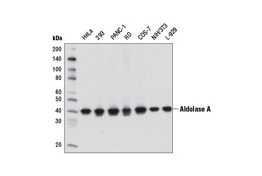 Glycolysis II Antibody Sampler Kit - 1 Kit