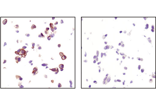 SignalSlide® Phospho-Akt (Ser473) IHC Controls - 1 Pack