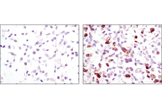 SignalSlide® Phospho-EGF Receptor IHC Controls - 1 Pack