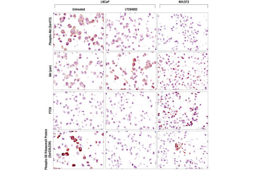 SignalStain® Akt Pathway IHC Sampler Kit - 1 Kit