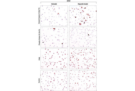 SignalStain® Proliferation/Apoptosis IHC Sampler Kit - 1 Kit