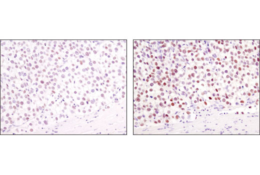 SignalStain® Boost IHC Detection Reagent (HRP, Mouse) - 1 ml