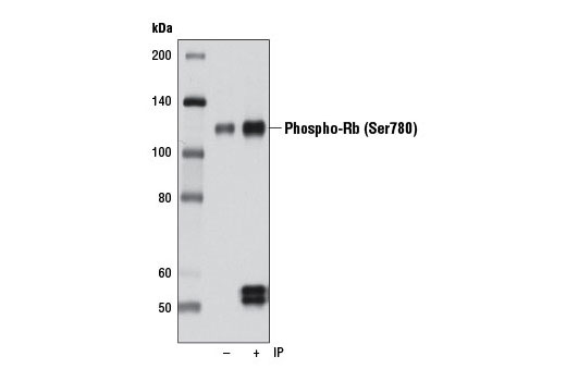 Rb Antibody Sampler Kit - 1 Kit