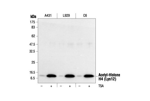 Acetyl-Histone H4 Antibody Sampler Kit - 1 Kit