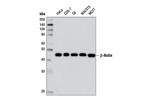 Cytoskeletal Marker Antibody Sampler Kit - 1 Kit