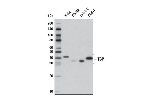 TBP Antibody - 100 ul