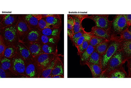 Organelle Localization IF Antibody Sampler Kit - 1 Kit