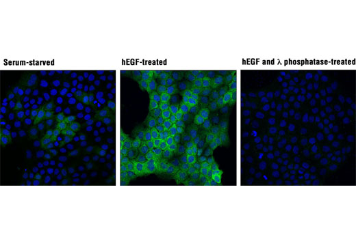 p90RSK Antibody Sampler Kit - 1 Kit