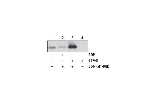 Active Ras Detection Kit - 1 Kit