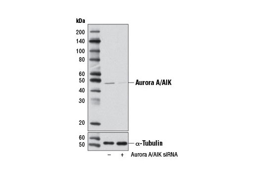 SignalSilence® Aurora A/AIK siRNA I - 300 ul